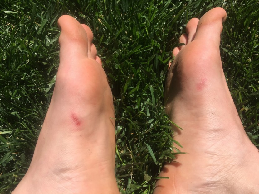 barefoot shoes womens - the consequences of running barefoot in minimalist shoes that were...